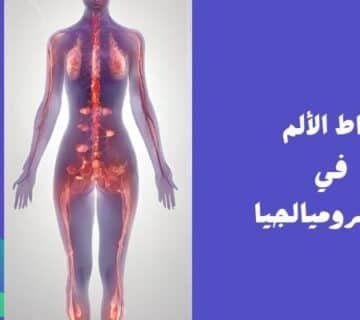نقاط الألم في الفيبروميالجيا (1)